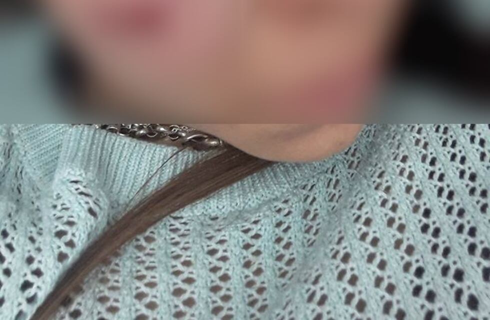 Brutal asalto y golpiza a una estudiante universitaria