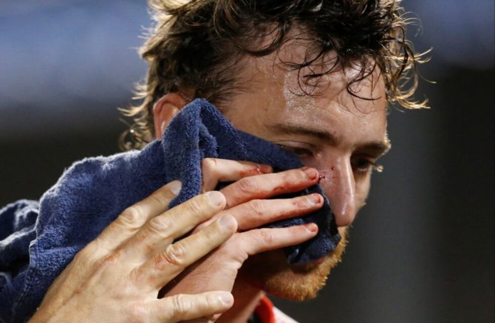 El terrible codazo a Amorebieta que el árbitro pasó por alto