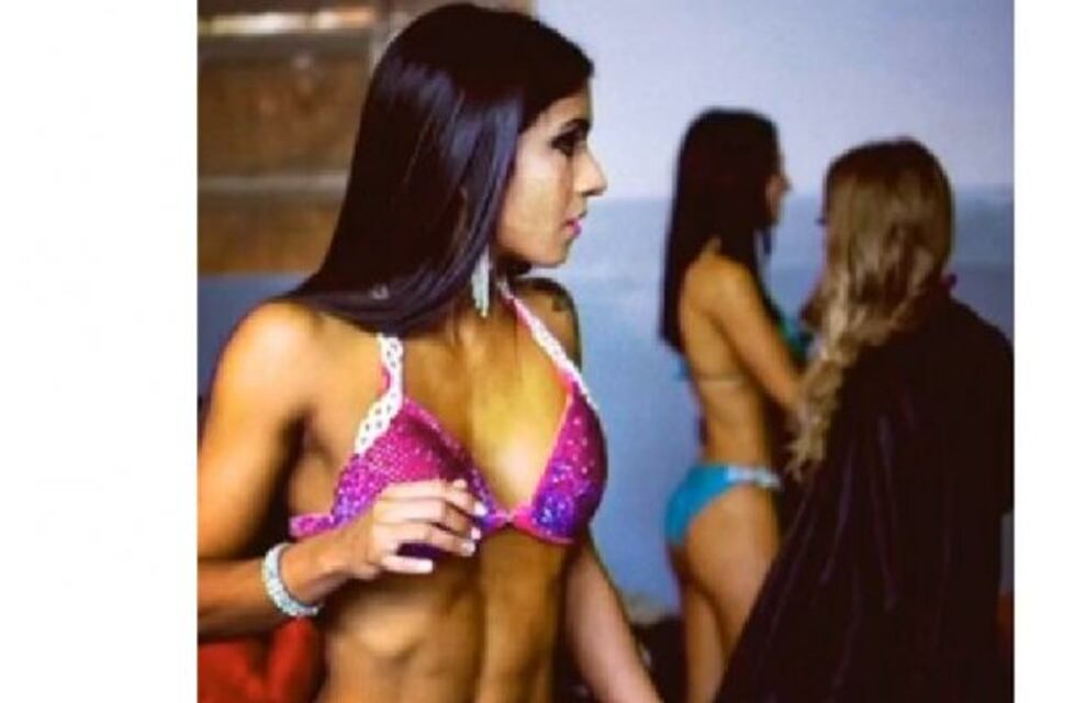 Compite en fitness, tomó suplementos y sufrió una hemorragia cerebral