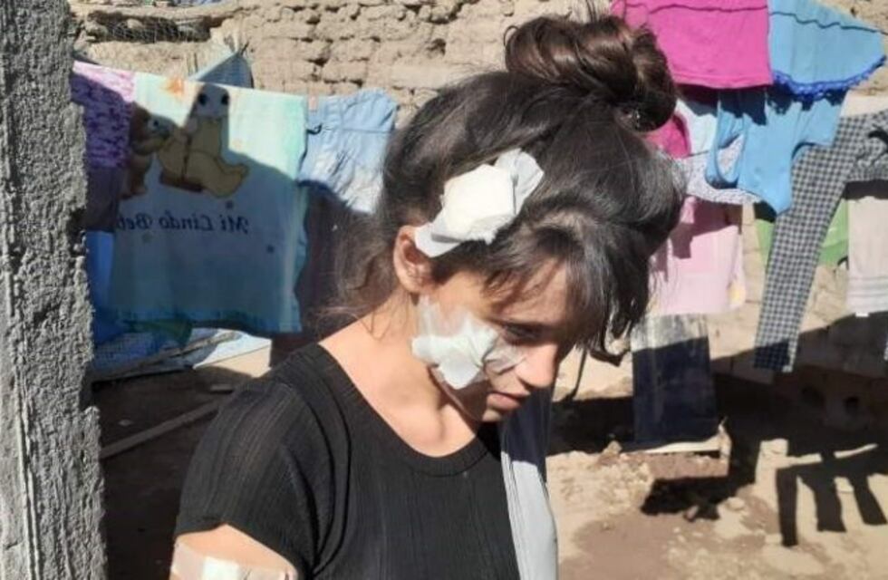 La confundieron con otra y la apuñalaron: "No sé cómo voy a mirar a mi hijo"