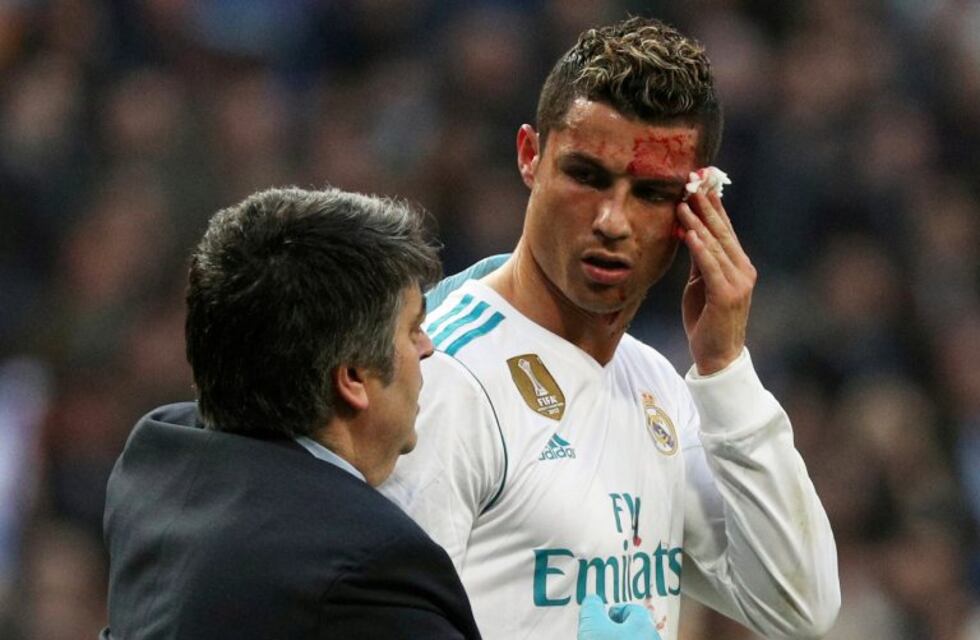 Cristiano Ronaldo se cortó la ceja y pidió prestado un celular para verse