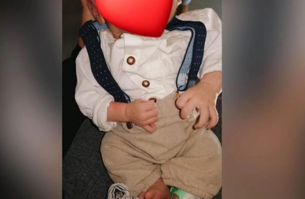 El "bebé sin rostro" cumplió un mes de vida y sus padres lo celebraron en las redes sociales