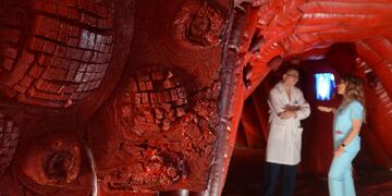El estilo de vida y el ambiente causan 75% de los casos de cáncer de colon