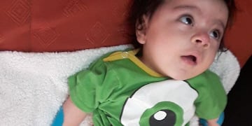 Campaña Solidaria: Felipe necesita varias intervenciones para mejorar su calidad de vida