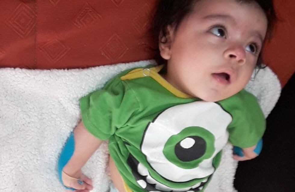 Campaña Solidaria: Felipe necesita varias intervenciones para mejorar su calidad de vida