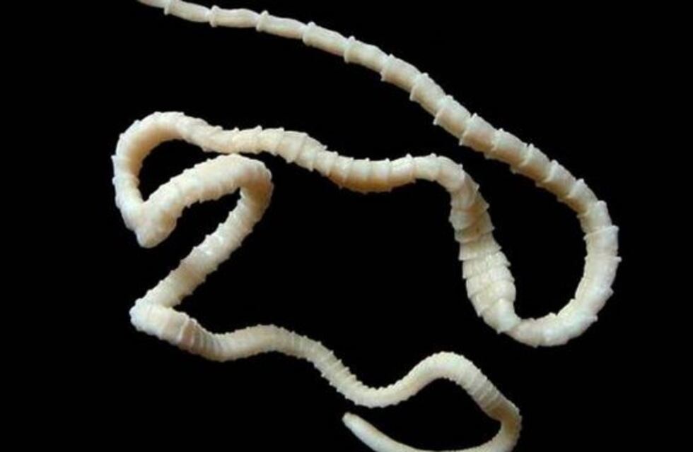 Sentía shocks eléctricos en sus piernas y tenía gusanos en su columna