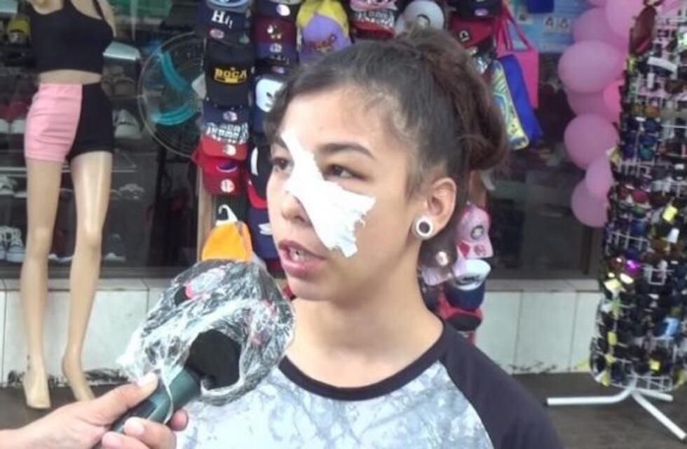 La joven herida en un cumpleaños dijo que ya identificaron al agresor