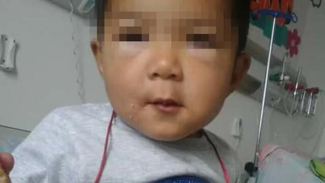 Matheo, el niño de 3 años, consiguió turno para operarse en Buenos Aires.
