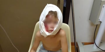Oberá: un niño de 7 años resultó seriamente herido tras el ataque de un perro rottweiler.