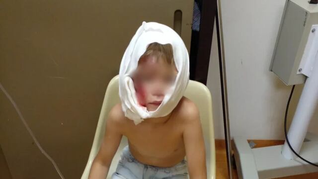 Oberá: un niño de 7 años resultó seriamente herido tras el ataque de un perro rottweiler.