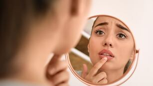 ¡Adiós a los labios agrietados!: estas son las 3 formas de mantenerlos hidratados durante las bajas temperaturas.