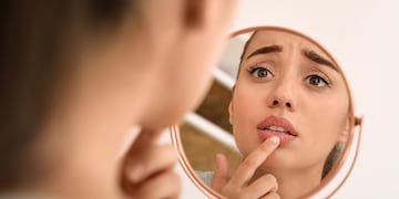¡Adiós a los labios agrietados!: estas son las 3 formas de mantenerlos hidratados durante las bajas temperaturas.
