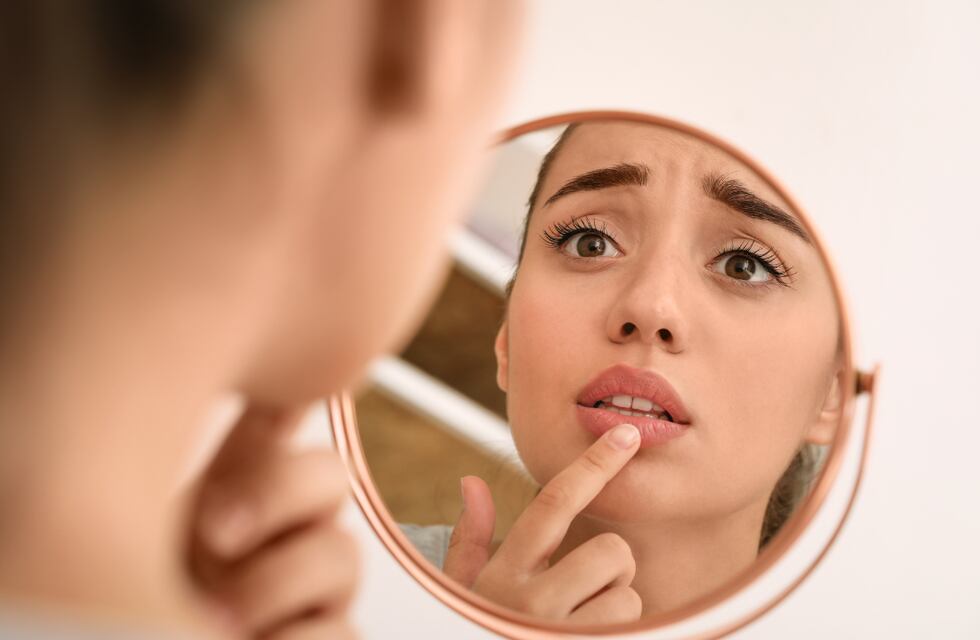 ¡Adiós a los labios agrietados!: estas son las 3 formas de mantenerlos hidratados en el invierno