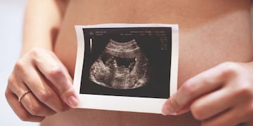 Violencia obstétrica