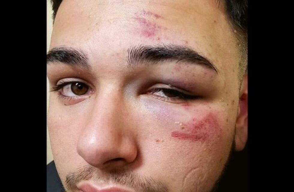 Denuncia que su hijo fue golpeado en un boliche del Chateau