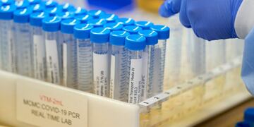 A lab at Methodist Dallas Medical Center prepares viral transport media for samples before collecting samples for coronavirus disease (COVID-19) in Dallas, Texas, U\u002ES\u002E June 24, 2020\u002E REUTERS/Cooper Neill TPX IMAGES OF THE DAY