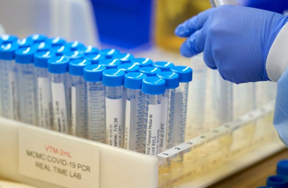 Chubut sumó un nuevo caso y ya son 104 los positivos de coronavirus