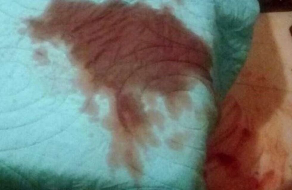 "Cómo seccionar genitales masculinos", escribió en Internet la acusada días antes del ataque