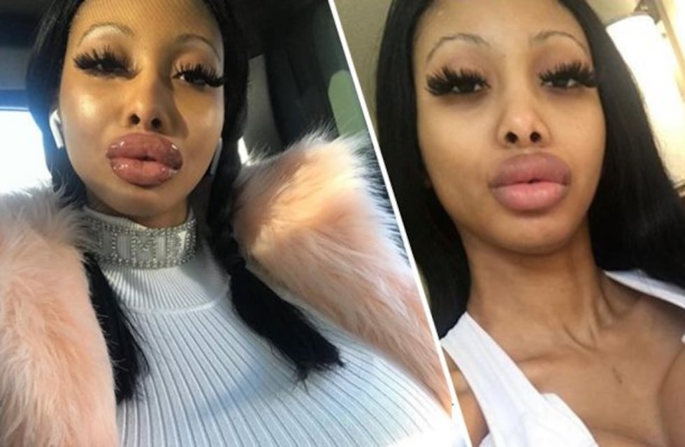 Ruby Doll Sunset, la joven que se hizo una cirugía estética para "desafiar la gravedad"