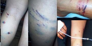 heridas que dejó una jauría de perros