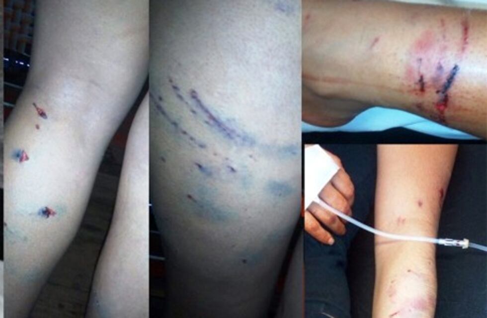 Jauría atacó a una mujer y su sobrina en Los Helechos