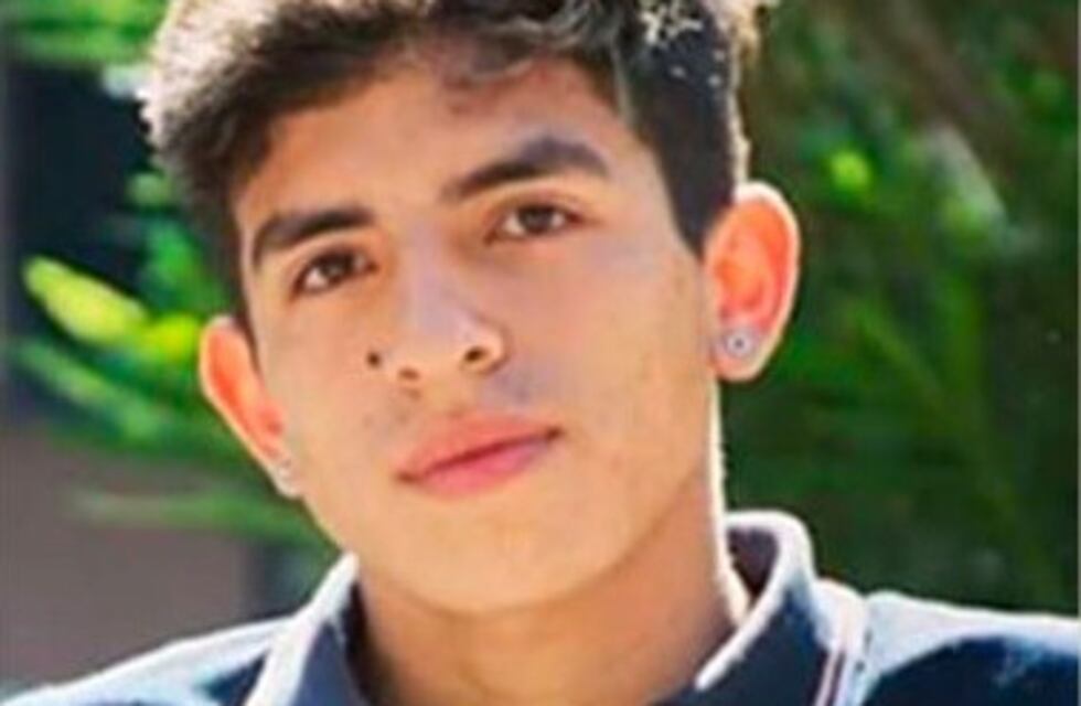 Joven de 18 años espera una prótesis tras ser golpeado en una fiesta