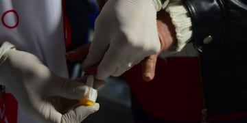 Hepatitis virales\u002E