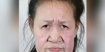 El sorprendente cambio de una joven de 15 años que parecía de 60