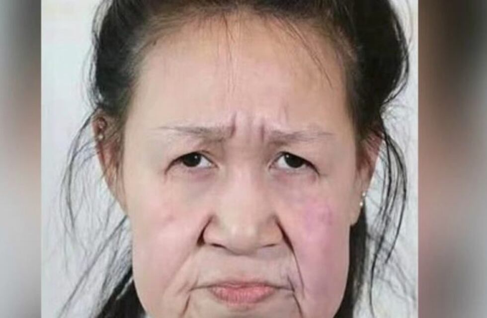 El sorprendente cambio de una joven de 15 años que parecía de 60