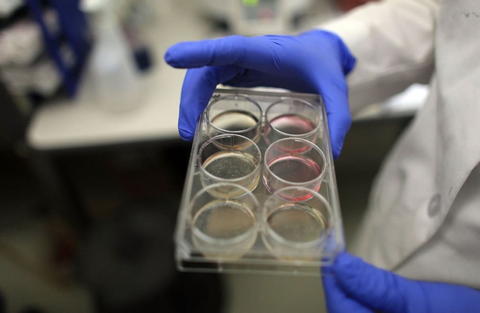 Alarmante: 8 de 10 muestras rafaelinas resultaron de Manaos