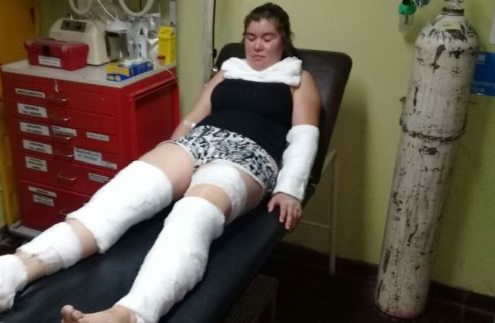 Le explotó el horno en la cara a una mendocina que alquiló en La Serena
