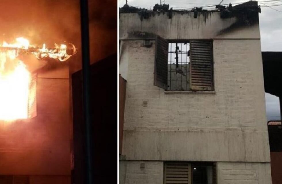 Una mujer sufrió quemaduras en el 70% de su cuerpo tras incendiarse su casa