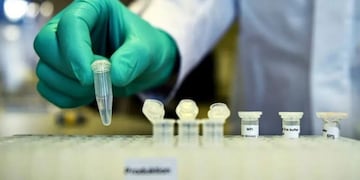 COVID-19: en Chaco fueron detectados 21 casos nuevos.