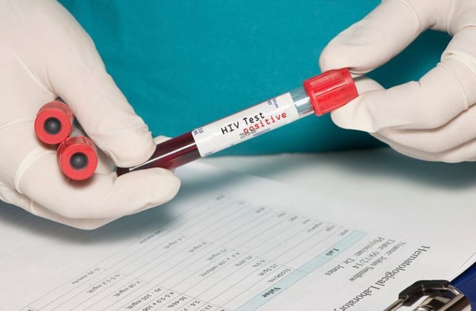 Diagnostican 70 casos por año de HIV en La Rioja