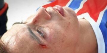 Francisco Salinas, habría sufrido un corte en la parte superior del ojo derecho\u002E