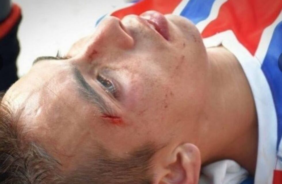 Jugadores de Peñarol de San Juan sufrieron una violenta agresión en San Rafael