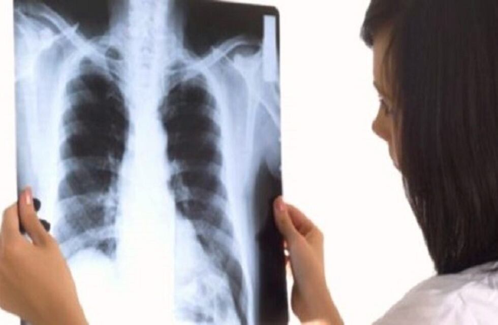 Ahora el Subsidio de Salud valida Online estudios por imagenes