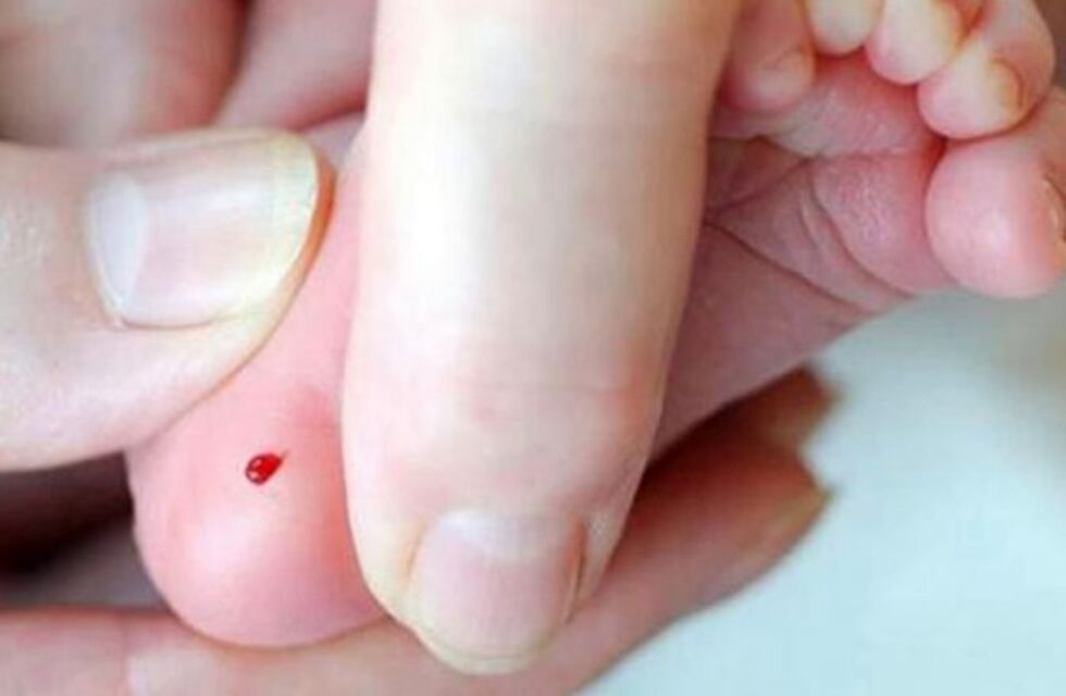 Salud: programa de pesquisa neonatal obtuvo dictamen favorable