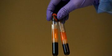 Coronavirus análisis\u002E Imagen Ilustrativa\u002E