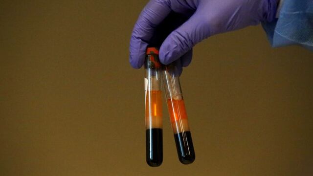 Coronavirus análisis\u002E Imagen Ilustrativa\u002E