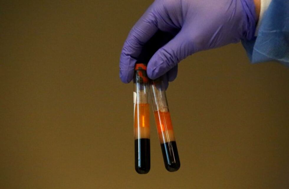 Coronavirus: este viernes se confirmaron cinco nuevos contagios en Carlos Paz