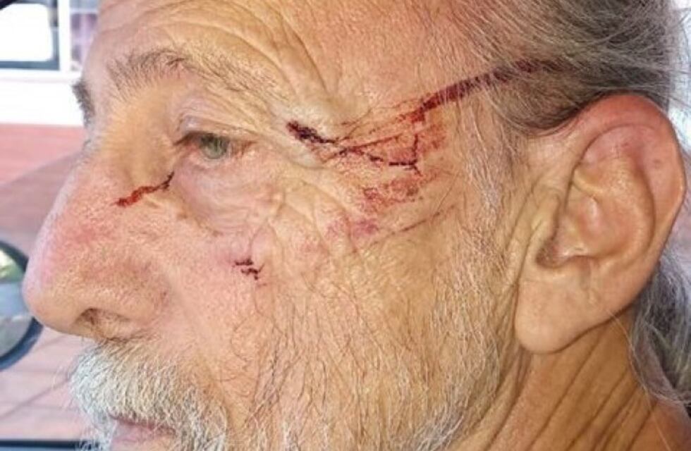 Ataque a un integrante de la Pastoral Aborigen en tierras guaraníes