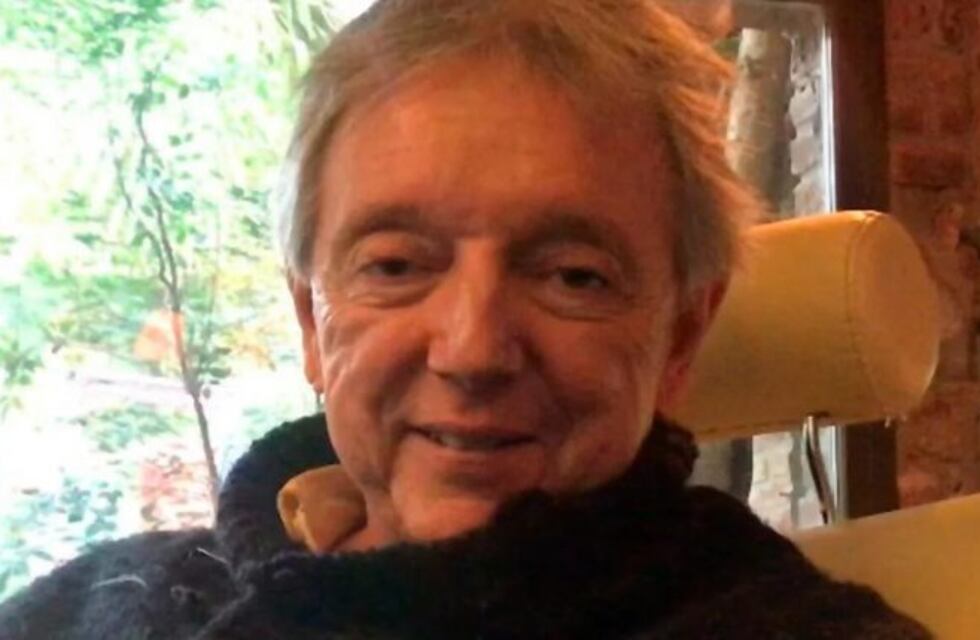 Pepe Cibrián dejó un mensaje en las redes tras sufrir siete fracturas en el rostro