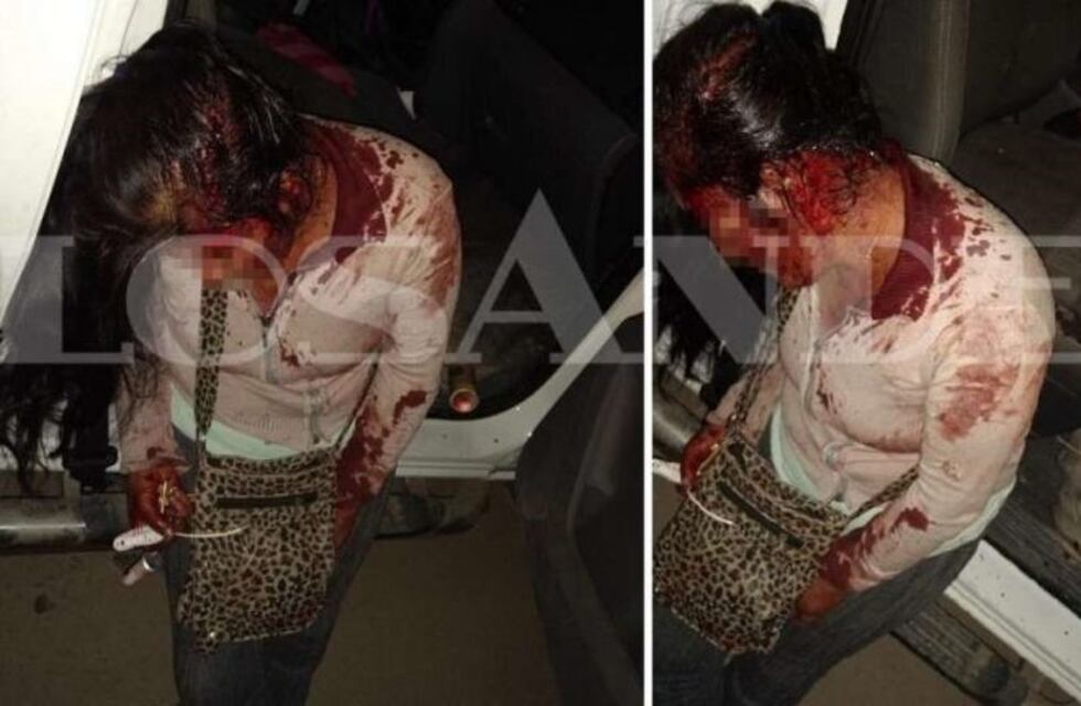 Un hombre casi mata a su pareja pegándole en la cabeza con un desodorante