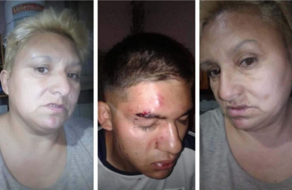 Un caniche desató una "guerra" entre dos familias sanjuaninas