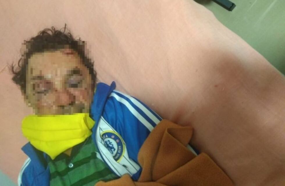 Encontraron a un hombre brutalmente golpeado
