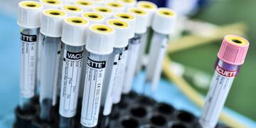 5 casos nuevos de Covid-19 en Córdoba\u002E