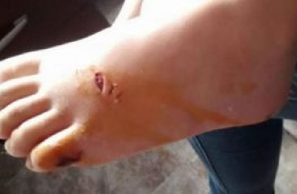 Ataques de tarariras obligaron a cerrar el Fantasio por unas horas