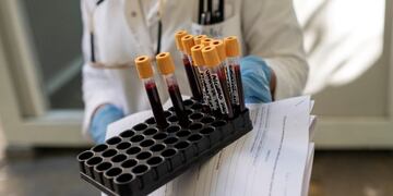 Coronavirus test\u002E