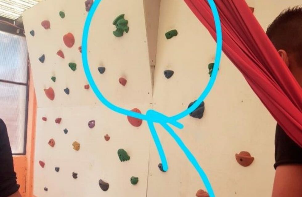 Una nena perdió el dedo mientras hacía palestra en San Luis